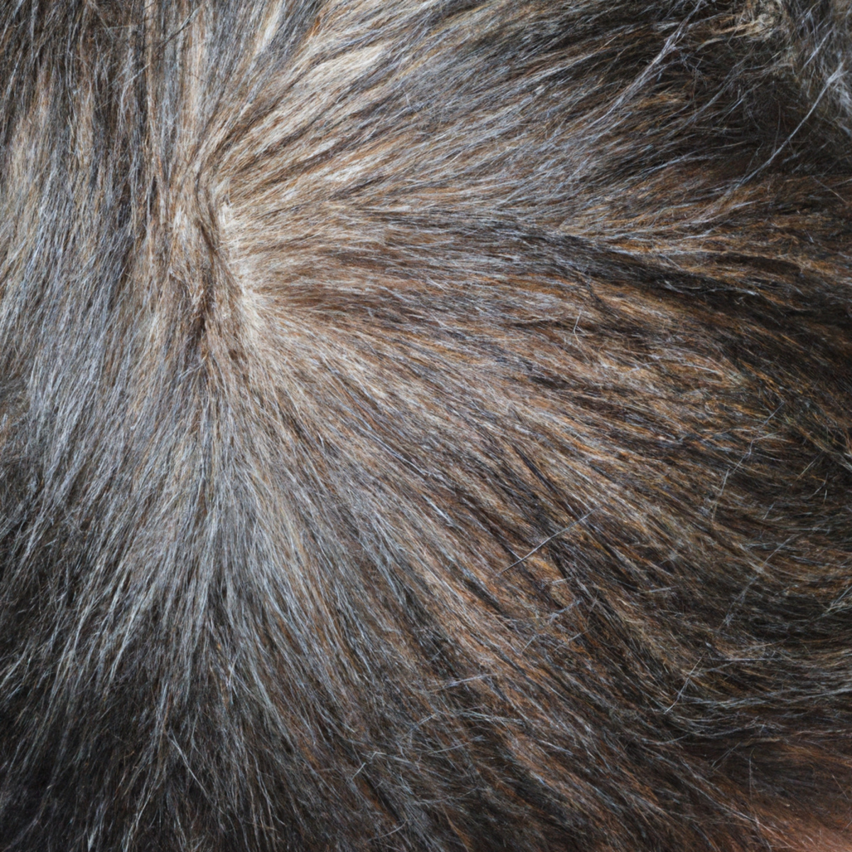 Patchy hair follicles, thin strands, reduced density. Smooth scalp lacking sweat or oil secretion. Hypohidrotic Ectodermal Dysplasia's impact on sweat gland development.