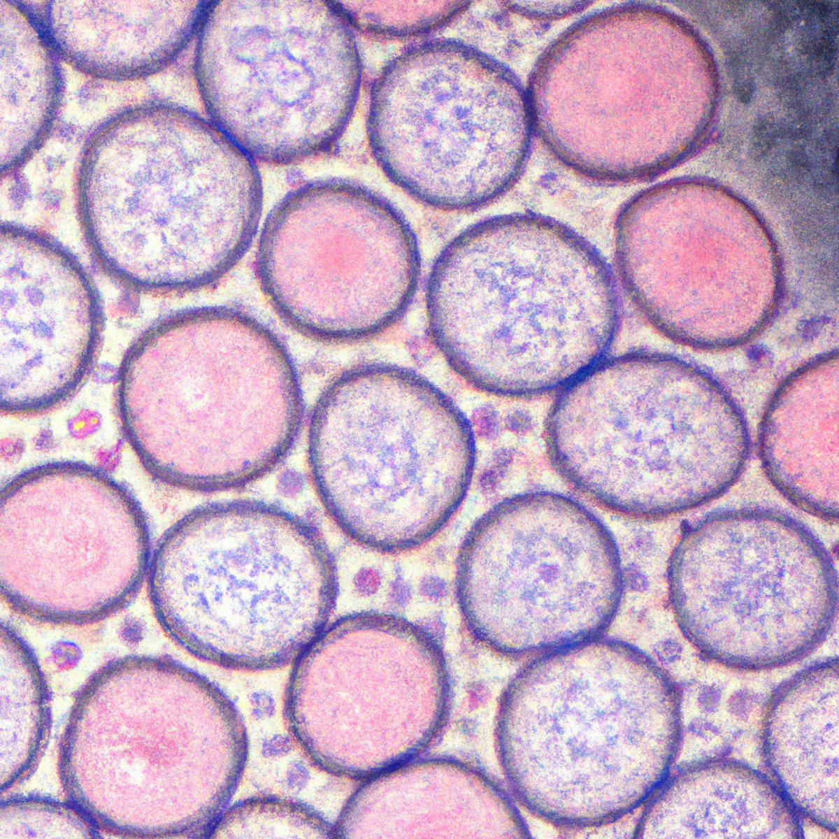 Close-up photo of Langerhans cells on microscope slide, displaying distinct morphology and Birbeck granules.